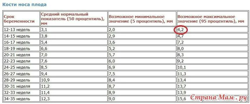 Норма носовой кости в 20 недель. Размер носовой кости в 12 недель норма. Размер кости носа на 12 неделе беременности норма. Кости носа в 13 недель беременности норма таблица. Кость носа по неделям беременности.