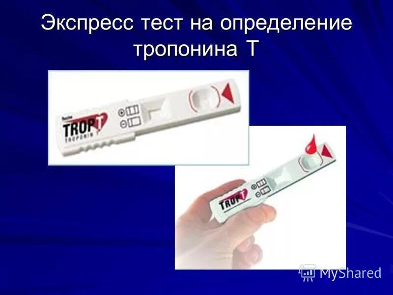 Тест на определение теста гнева. Тест на определение теста гнева