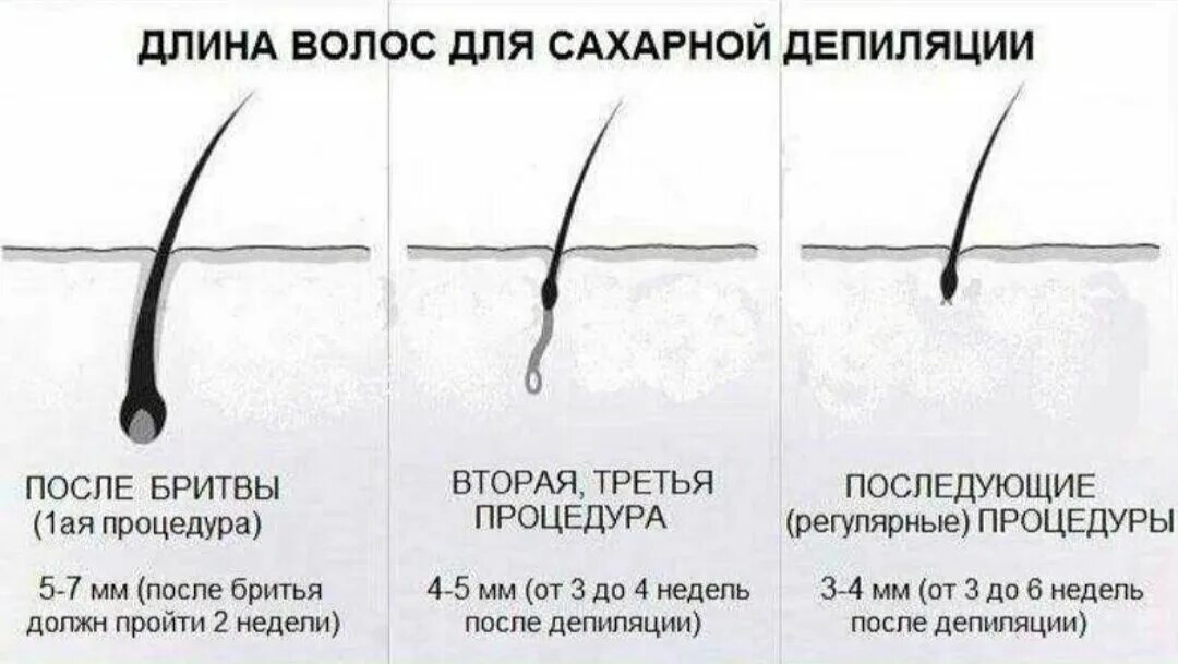 Схемы роста волос для депиляции. Шугаринг бикини. Депиляция сколько см. Эпиляция бикини глубокое. Сколько надо отращивать волосы.