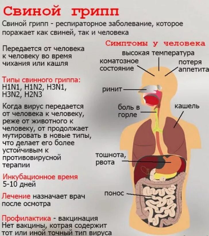 Лечение гриппа 2025 у взрослых году симптомы. Свиной грипп. свиной грипп симптомы. свиной грипп симптомы у людей.