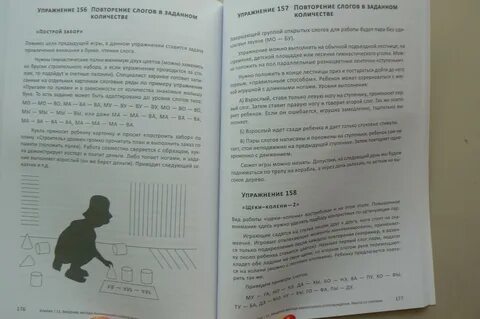 Алалия большаковой