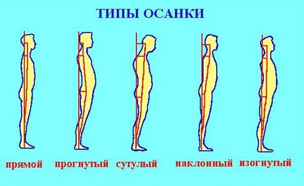 Нормальным считается тип осанки. Типы осанки по штаффелю. типы неправильной осанки. нормальный тип осанки. нарушение осанки по штаффелю.