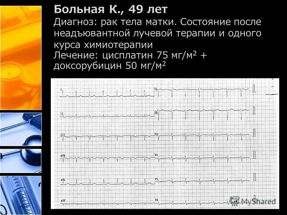 Пациент 65 лет с диагнозом