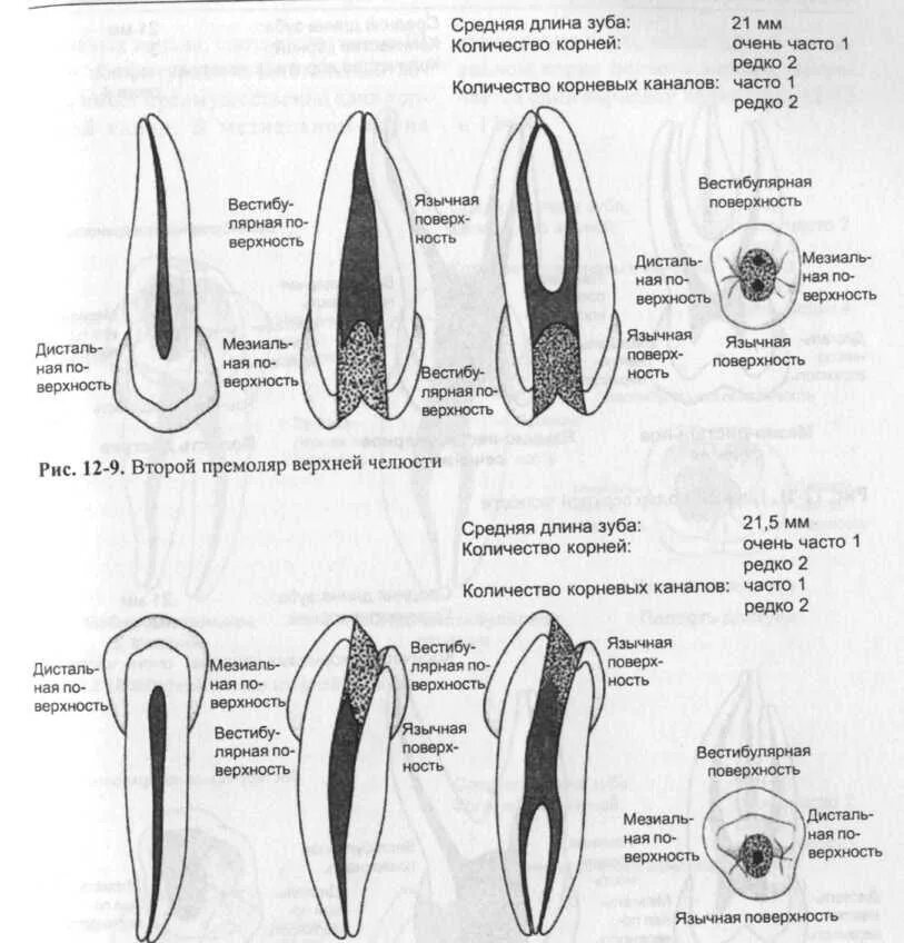 Корневые каналы премоляров верхней челюсти. Анатомия корневых каналов зубов верхней челюсти премоляры. Второй верхний премоляр анатомия корневых каналов.