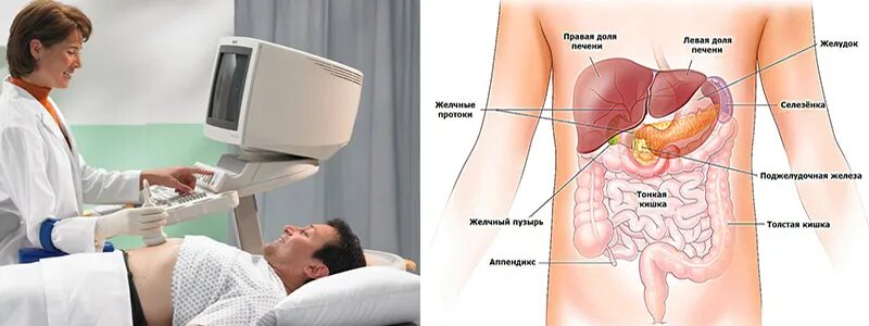 Узи брюшной полости врачи отзывы. Ультразвуковое исследование органов брюшной полости (УЗИ). УЗИ органов брюшной полостт. УЗИ органов брюшной полостиэ. УЗИ га брюшной полости.