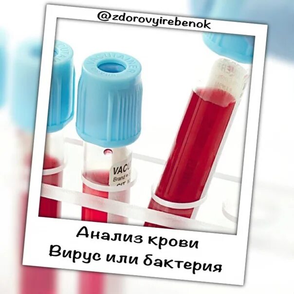 Анализ крови вирус или бактерия. Вирусная кровь. Кровь бактериальная или вирусная. Как определить кровь или краска. Как отличить кровь