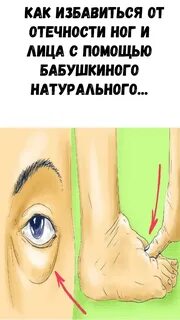Как избавиться от отеков