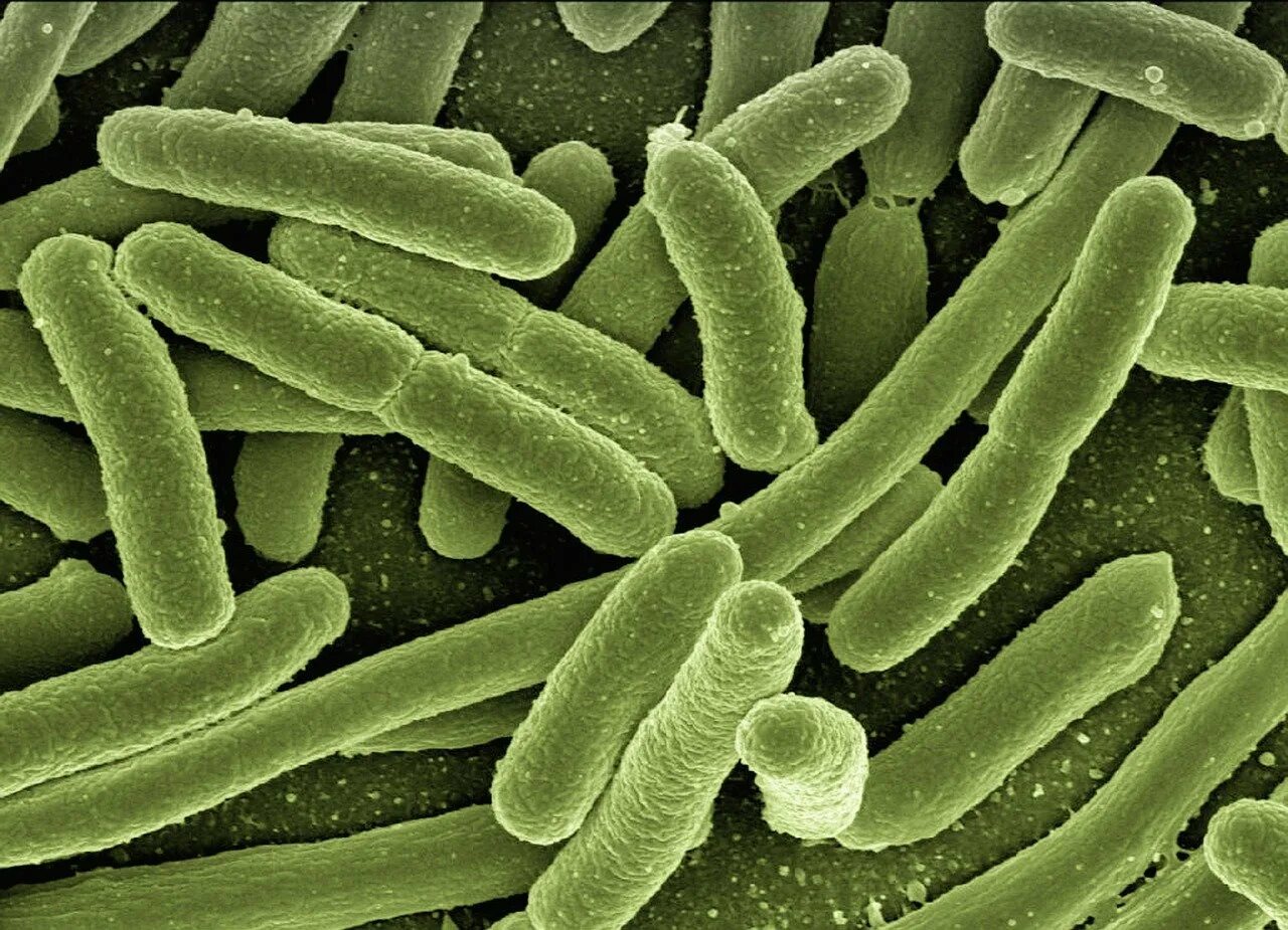 Бактерия чужеродная. Бактерия Escherichia coli. Кишечная палочка микрофотография. Бактерия синегнойная палочка. Эшерихии палочковидные.