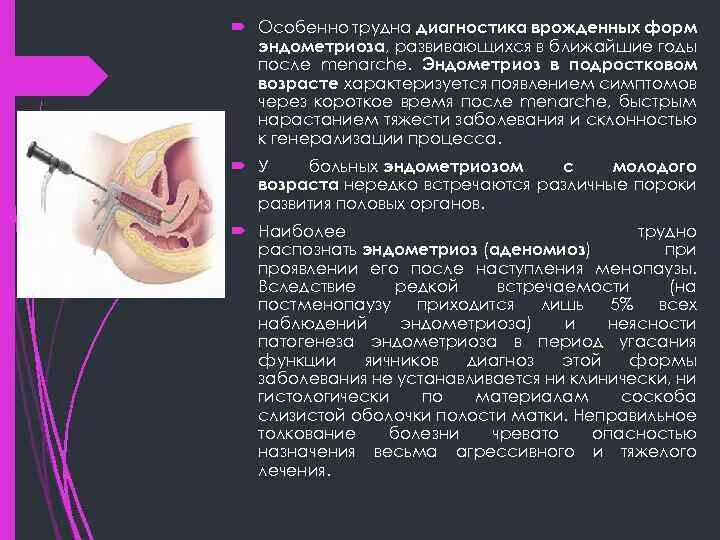Как диагностируется эндометриоз. Эндометриоз наружных половых органов. онкогинекология диагностика. эндометриоз проблемы пациента. период развития эндометриоза.