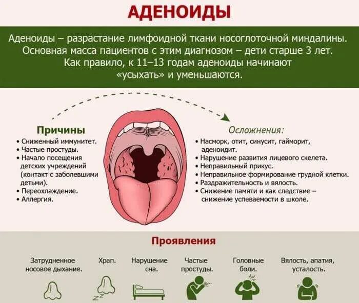 Что делать при аденоидах. Увеличением объема лимфоидной ткани (аденоиды),. Аденоидит у детей признаки.