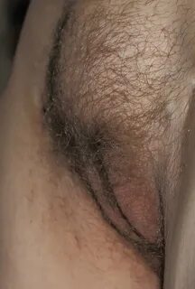 Female pubic hair thread 