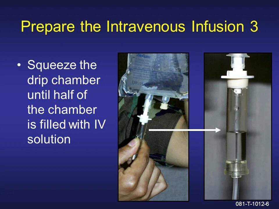 Intravenous трейнер. Parenteral infusion. intravenous игра.
