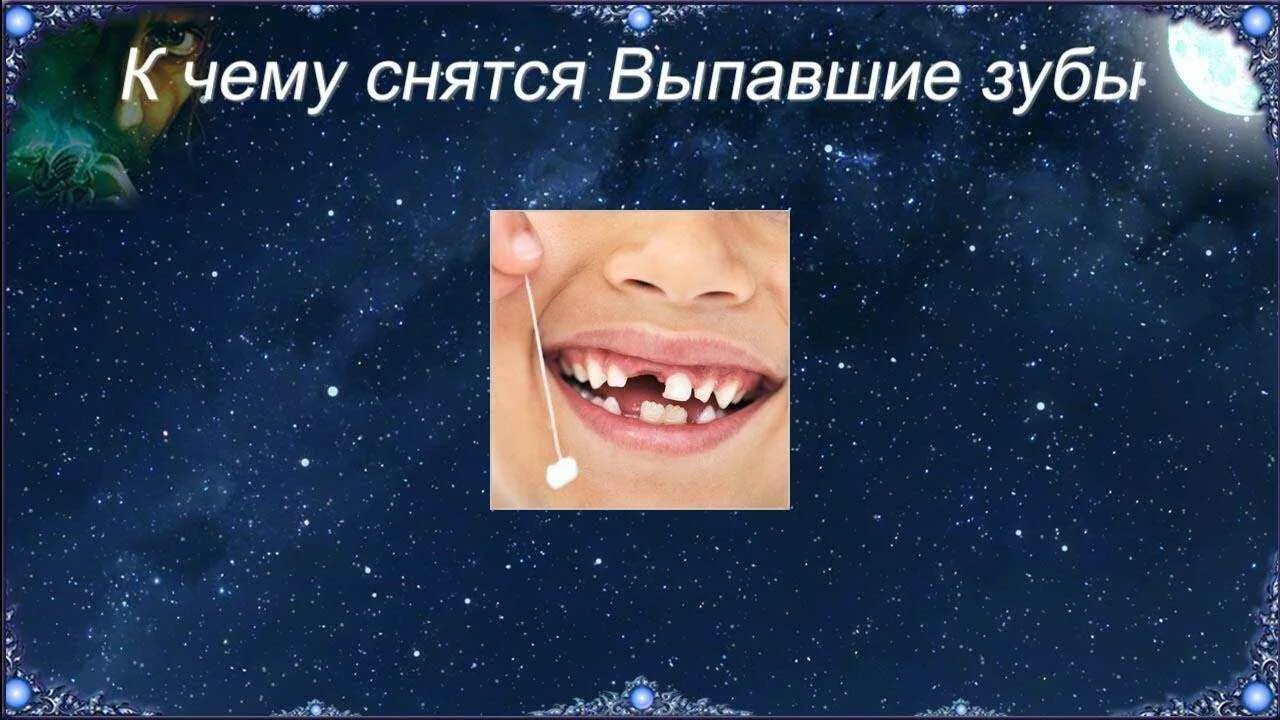 К чему снится выпавший зуб.