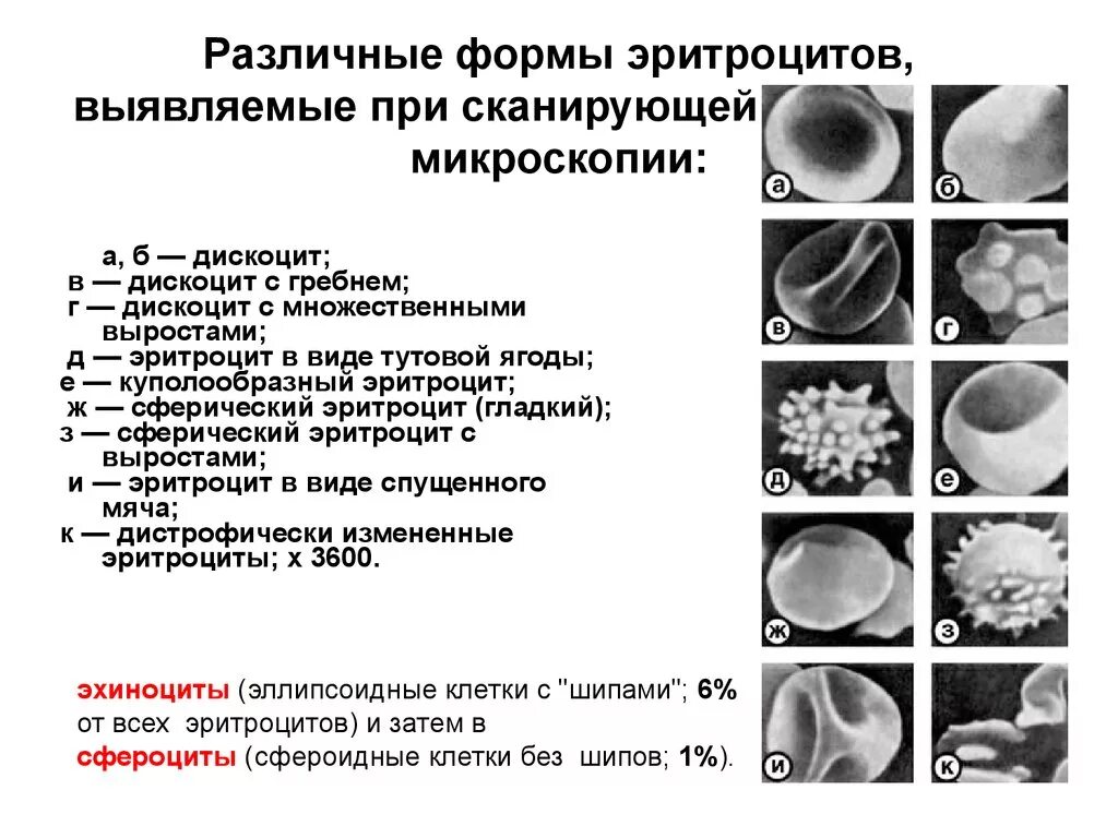 3 признака эритроцитов. Форменные элементы крови Электронограмма. Стареющие формы эритроцитов. Дискоциты. Эритроциты разной формы.