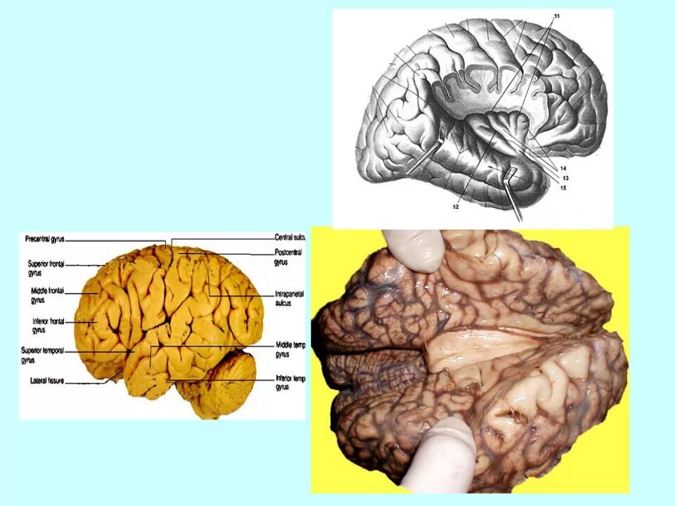 Мозолистое тело конечного мозга функции. Строение и функции конечного мозга больших полушарий. Строение конечного мозга мозолистое тело. Мозолистое тело соединяет полушария.