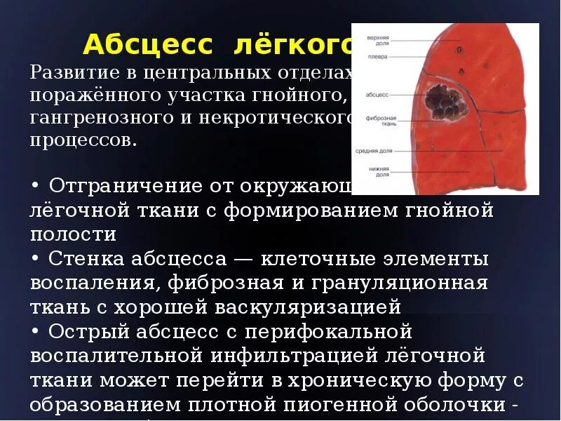 После абсцесса легкого. Морфология острого абсцесса легкого. Абсцесс легкого оболочки. Острый абсцесс легкого. Абсцесс легкого синдромы.