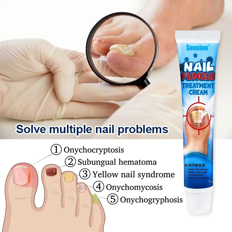 Sumifun мазь от грибка ногтей. Fungus treatment cream. Мазь nail repair cream. Fungus treatment cream. Fungus treatment cream.