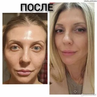 Фото до и после коррекции