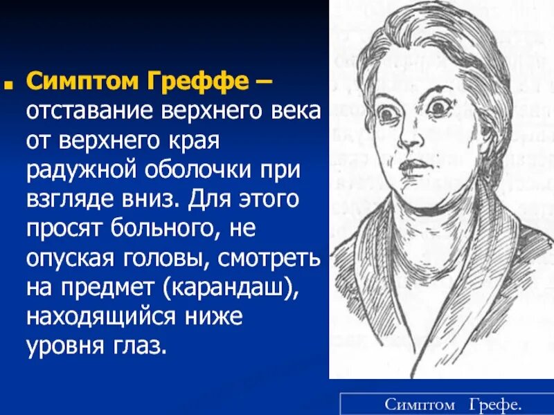Синдром грефе. Положительный симптом грефе.