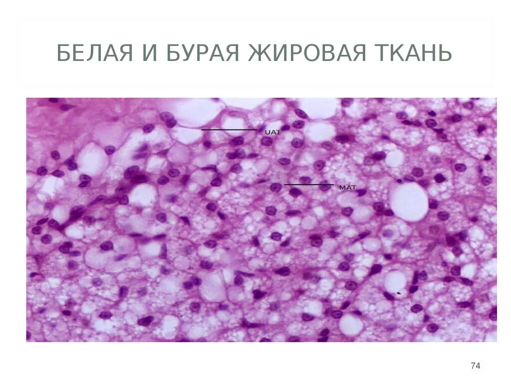 Липоциты. Бурая жировая ткань микропрепарат. Бурый жир гистология. Белая и бурая жировая ткань гистология. Бурая жировая ткань гистология препарат.