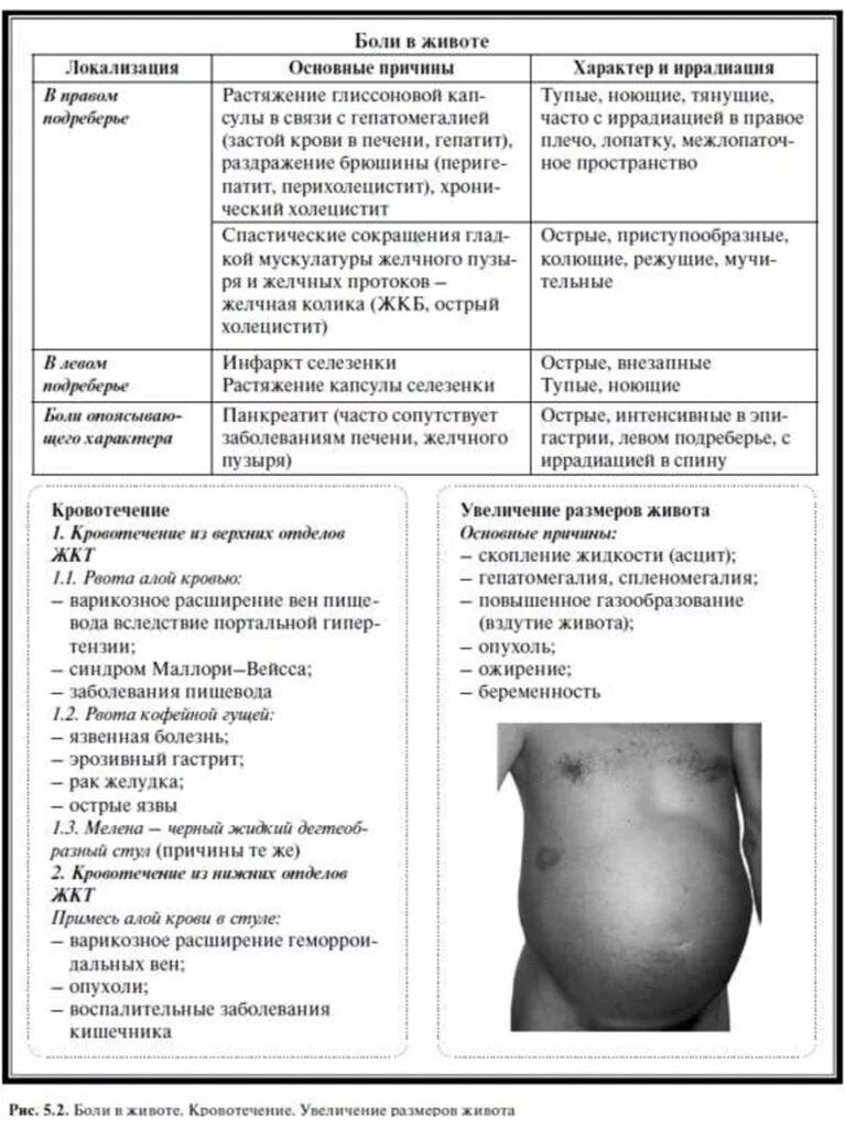 Асцит напряженный карта вызова. Живот при заболевании печени. Форма живота при асците.