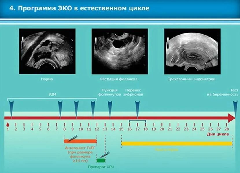 Схема стимуляции овуляции. Протокол стимуляции овуляции для эко. Стимуляция овуляции короткий протокол эко. Эко протокол по дням в естественном цикле. Стимуляция овуляции протокол схема.