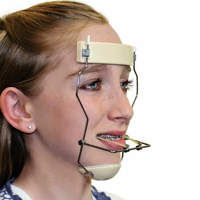 Pin on Veneers in 2024 Face plastic surgery, Plastic surgery, Face surgery