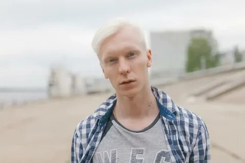 Альбинос это