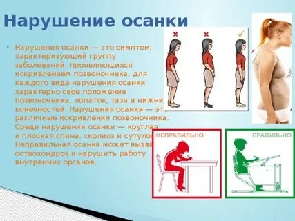 Физическая культура осанка