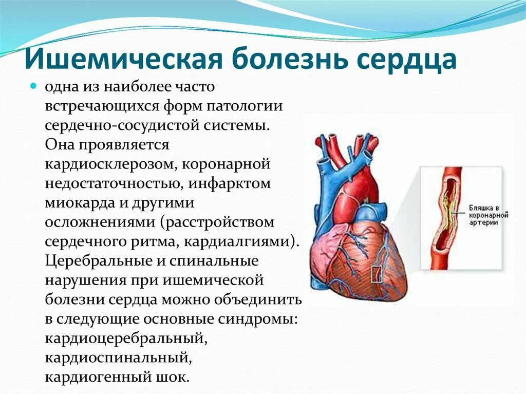 Ишемическое сосудистое заболевание. Ишемическая болезнь сердца. Заболевания сердца болезни. Патология сердечно сосудистой системы.