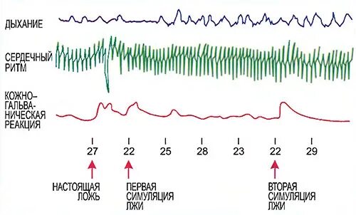 Результаты детектора лжи. Результаты полиграфа. Полиграф диаграмма. Показатели детектора лжи. Полиграмма полиграфа диана 7.