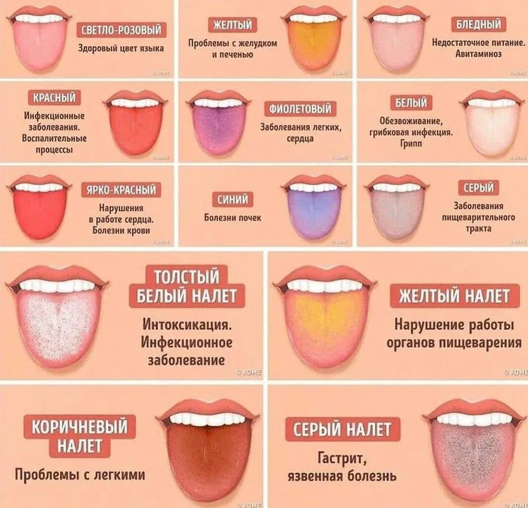 Язык признак какой болезни. Заболевания по цвету языка.