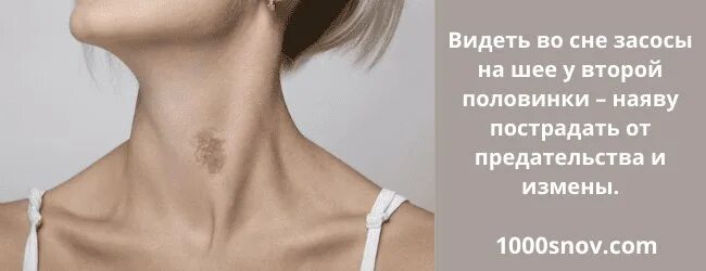 Как можно убрать засос. Как выглядит засос на шее.