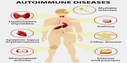 Заболевания иммунной системы картинки. Autoimmune disease. Autoimmune disease. Эндокринология картинки. Immune disease.