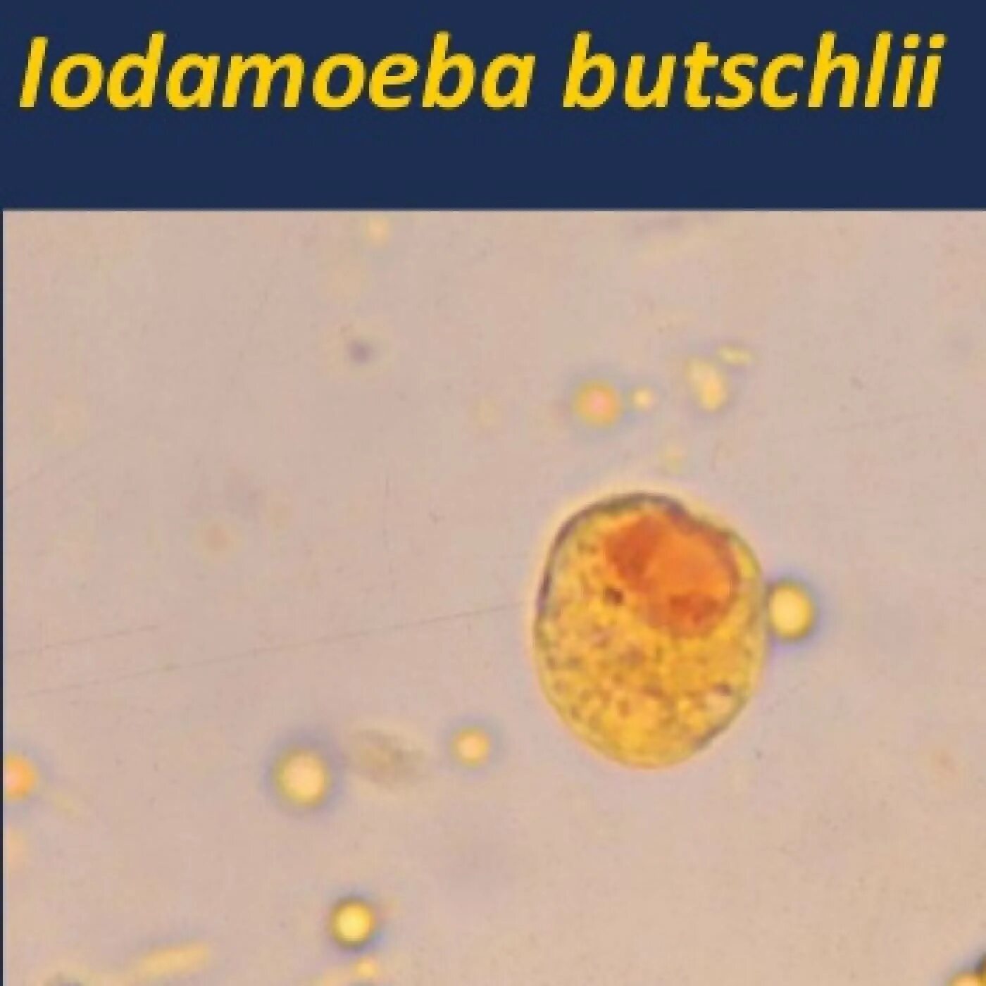 Entamoeba histolytica циста. Цисты Entamoeba. Iodamoeba Butschlii. Йодамеба Бючли. Entamoeba coli в кале