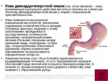 Бананы при язве двенадцатиперстной кишки можно