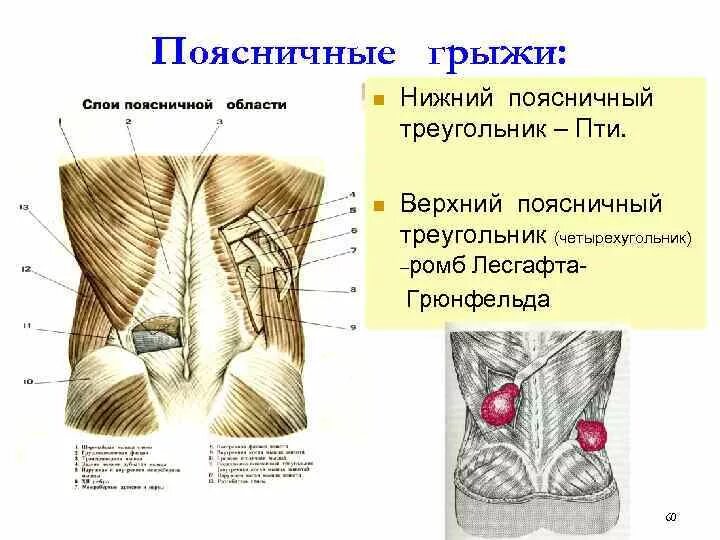 Какое анатомическое образование является дном trigonum lumbale