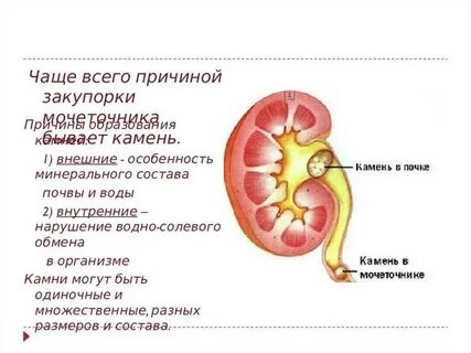 Температура при боли в почках