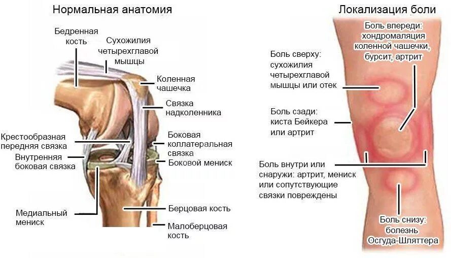 Бедра снизу. Болит с внешней стороны колено сбоку болит. Боли при згибании и разгибание в колене. Чего может болеть под коленкой сбоку с наружной стороны.