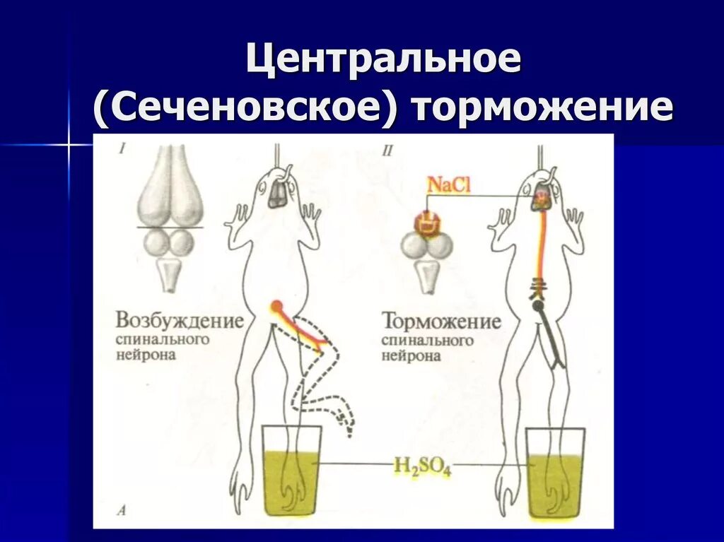 Центральное торможение Сеченова схема. Схема Сеченовского торможения. Сеченов центральное торможение. Схема Сеченовского торможения физиология.