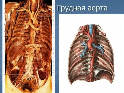 Аорта грудины