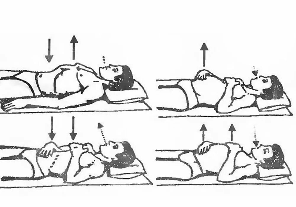 Дыхательная гимнастика для лежачих больных с переломом позвоночника. Дыхательная гимнастика при ушибе грудной клетки. Дыхательная гимнастика в послеоперационном периоде. Диафрагмальное дыхание при переломе позвоночника.