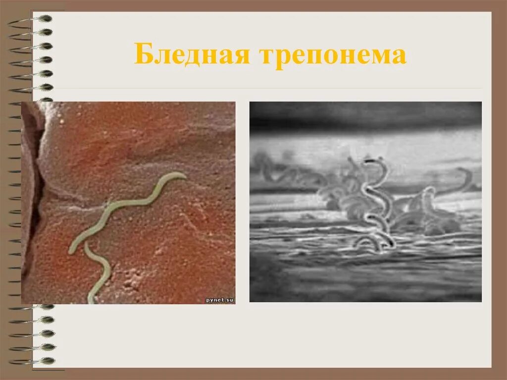 Бледная трепонема treponema pallidum. Бледная трепонема бледная. Бледная трепонема исход. Бледная спирохета это паразит.