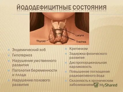 Диффузный токсический зоб эндемический зоб