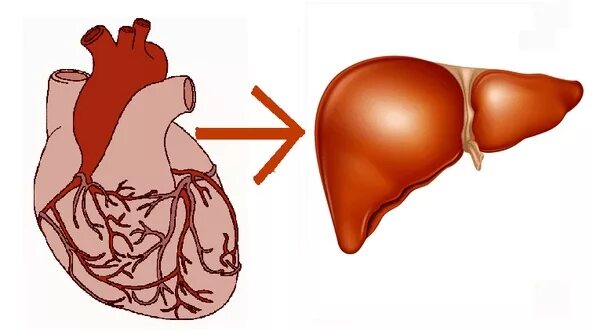Сердечно печеночная недостаточность. Печеночно сердечная недостаточность. Печень при хронической сердечной недостаточности. Сердечный цирроз печени.