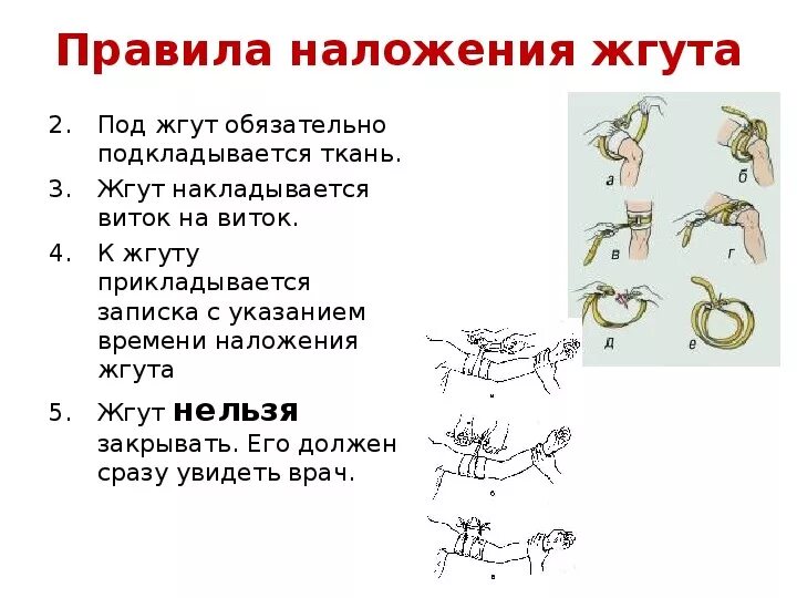 Сколько держать артериальный жгут. Правило наложение жгута ОБЖ. Пять правил наложения жгута. Правила наложения жгута время. Правильное наложение жгута таблица..