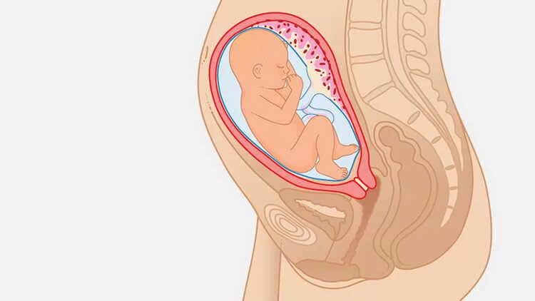 Плод на 26 неделе беременности. Расположение плода на 26 неделе беременности. Малыш на 26 неделе беременности в животе. Расположение малыша в животе. Матка на 35 неделе беременности