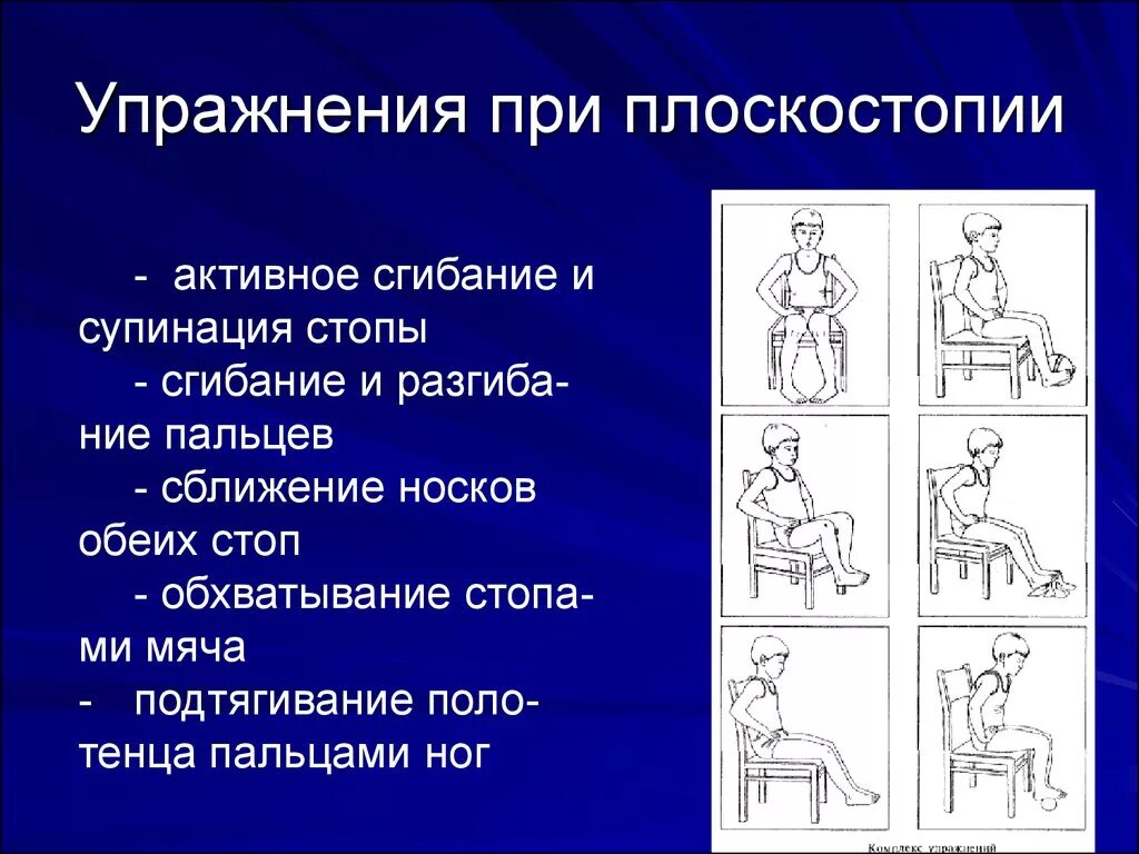 Комплекс упражнений для стопы. Упражнения при плоскостопии. Упражнения при плоскостоп и. Упражнения Ри плоскостопии. Комплекс упражнений при плоскостопии.