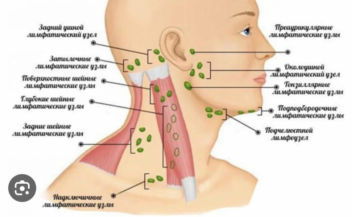 Лимфатический узел какой врач. Схема подчелюстных лимфоузлов. Воспалился подчелюстной лимфоузел лимфоузлы. Подчелюстные лимфатические узлы схема. Подчелюстные лимфоузлы схема.