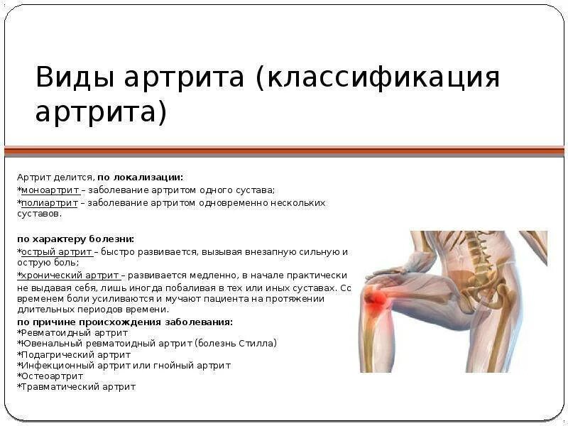 Ревматоидный артрит классификация коленный сустав. Артрит коленного сустава жалобы. Артрит коленного сустава схема. Болезнь суставов название.